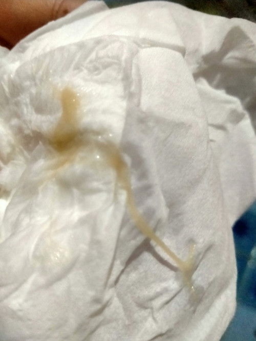 แบบนี้คือติดเชื่อไหมค่ะติดเชื้ออะไรอันตรายไหมค่ะมีหน่วงท้องเปนปกติยุแล้วท้อง3ค่ะ