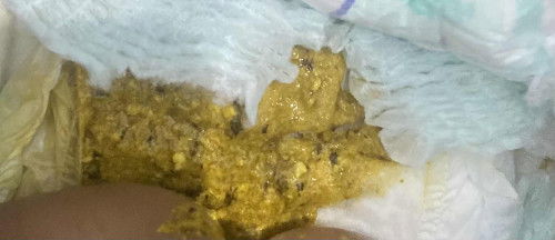 pup bayi ada bintik bintik hitam