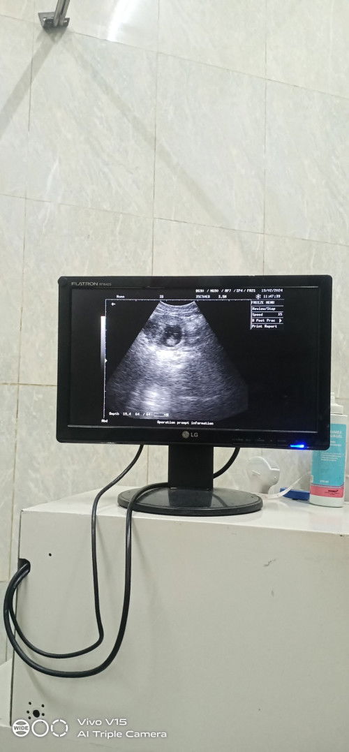 Masih bimbang ragu.. Baiknya usg lagi ato tidak