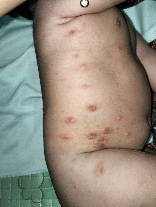 Sharing pengalaman nya bunda yang pernah mengalami.