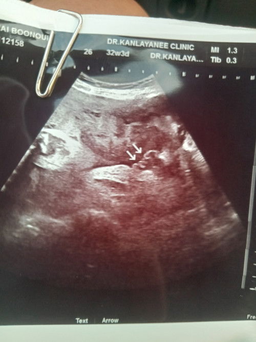 ช่วยดูหน่อยค่ะแม่ๆว่าหญิงหรือชาย