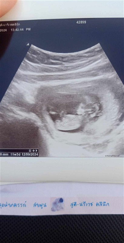 ทราบเพศกันตอนกี่วีคค่ะ