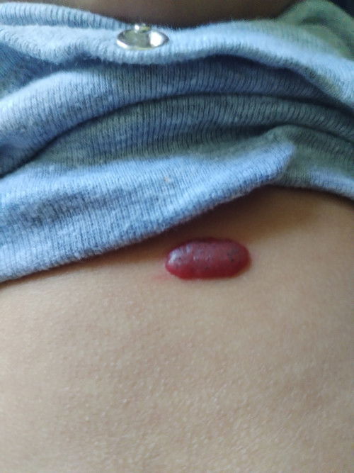 Ada sesiapa anak ada tanda ni tak?