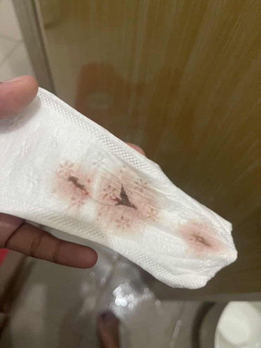 Is this Normal?