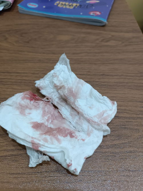 pendarahan umur 14 minggu