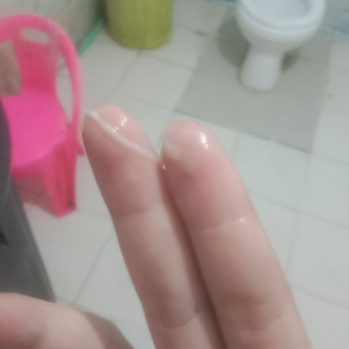 สอบถามเเม่ๆค่ะตอนนี้ตั้งครรภ์ได้37+1วีกมีเเบบนี้อกมาจากช่องคลอด2วันเเร้วปกติมั้ยค่ะหรือมันคืออะไรค่ะ