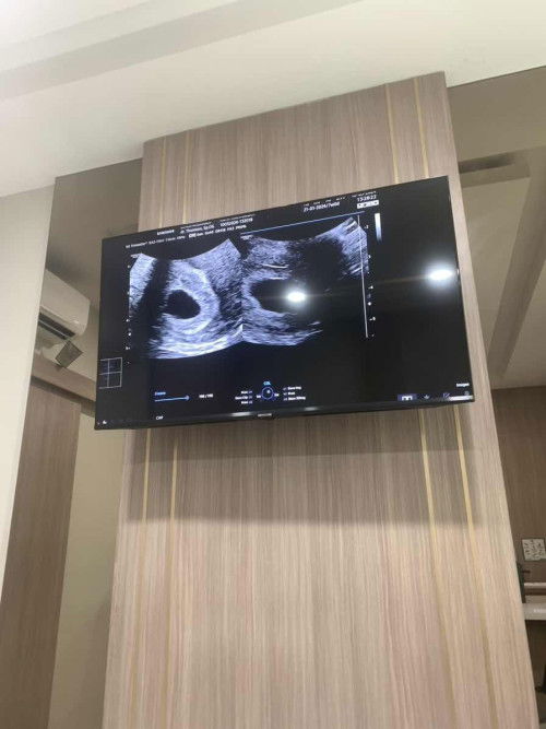 usg 7 minggu tp baru kantung nya saja