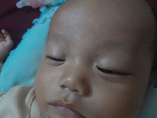 Putih putih di jidat