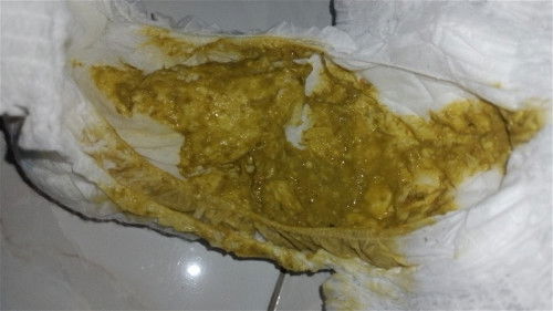 Pup bayi umur 7 bulan