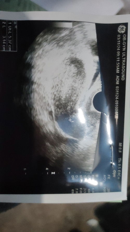 PCoS Free🙏🏻🙏🏻🙏🏻 I hope baby na sa Sunod.