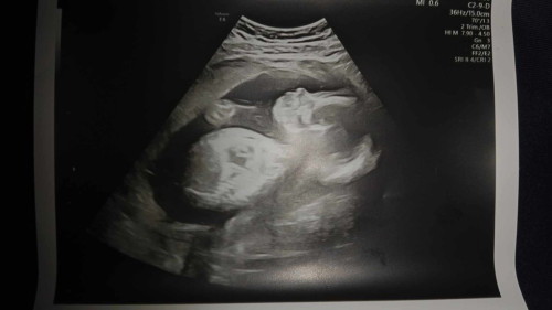 ลูกสาว ทีม กรกฎาคม