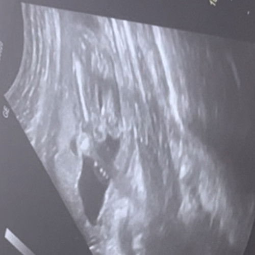 ช่วยดูเพศหน่อยค่ะแม่ๆ ช/ญ