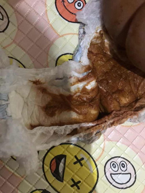 Bayi 6 bulan berak berdarah