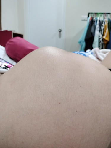 ท้อง36 weekอยู่ๆท้องก็แหลมแบบนี้ไม่ไปขยับไปไหนเลยแม่ๆคนไหนเป็นบ้างไหมคับ