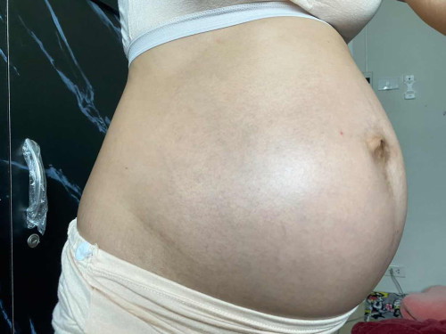 26 w ท้องสองใหญ่มากกก