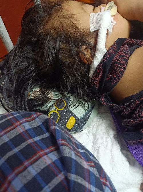 Cara menyembuhkan RSV