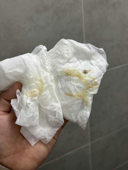 kalau macam ni tanda lagi berapa hari?