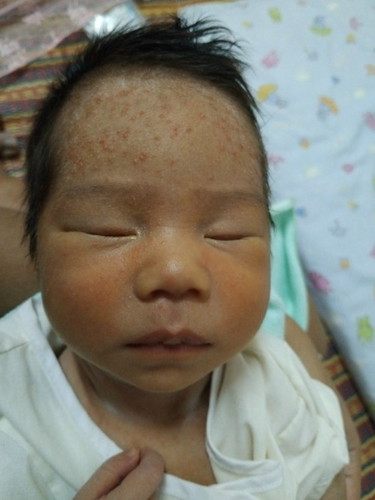 น้องคลอดได้10วัน