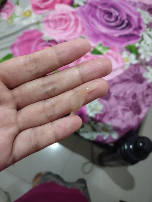 Apakah tanda lahiran