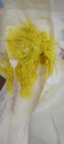 Warna najis