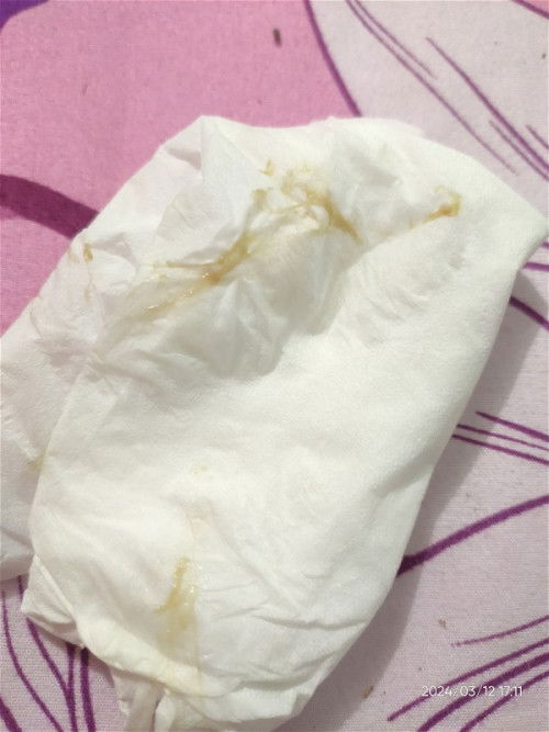 Keputihan & keluar bercak darah setitik