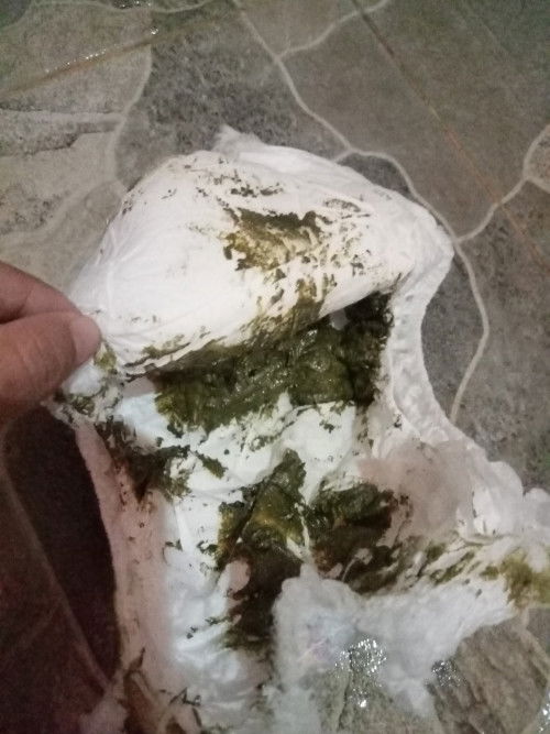 Maaf jorok. Bun ee baby saya kok warnanya kek gini ya hijau gtu. Usia 5 bulan. Saya beri sufor n ASI