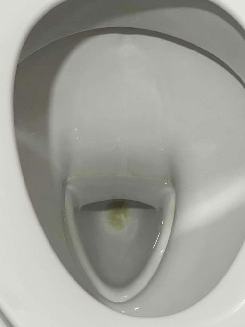 ตั้งครรภ์32++วิค ติดเชื้อแบคทีเรียทางช่องคลอด