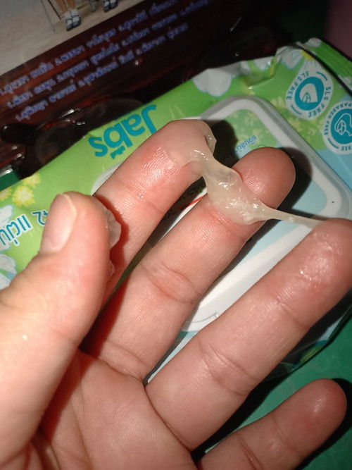 ตั้งครรภ์ 39+6 weeks มีมูกออกมาแบบนี้ แสดงว่าใกล้คลอดยังคะ