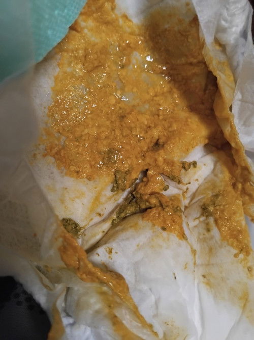 น้อง20วันนมแม่ล้วนค่ะ แบบนี้ปกติไหมคะ