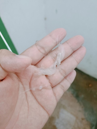 สัญญาณใกล้คลอดมั้ยค่ะ