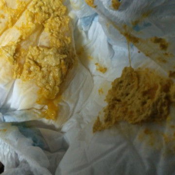 Bayi 2 bulan pup ada lendirnya