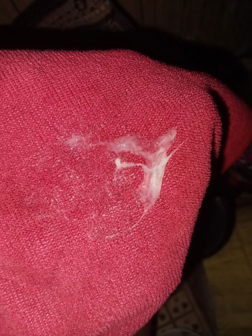 แบบนี้คือตกขาวหรือมูกค่ะ