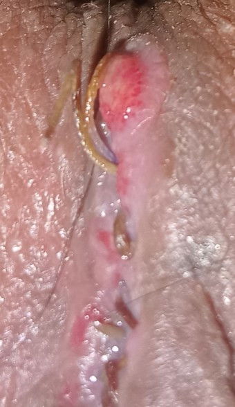 สอบถาม ค่ะ