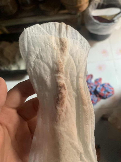 มีใครเคยเป็นไหมคะ