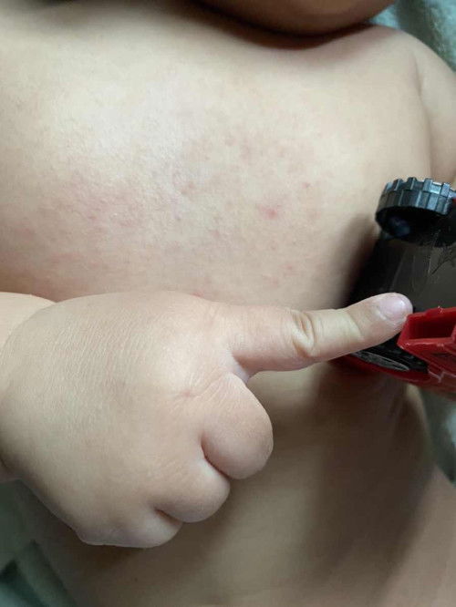 ini biang keringat kan ya?