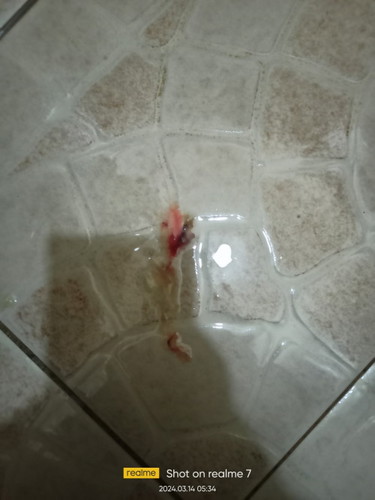 tanung ko lng po mga mamss..about sa discharge,1st time ko po ganitu discharge