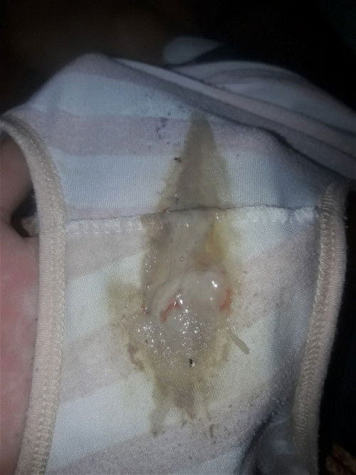 สอบถามแม่ๆค่ะ