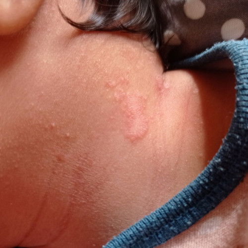 Bunda ada yg tau ini apa yaa?