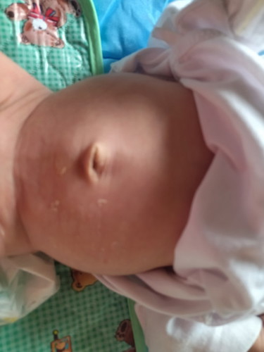 Normal lang po ba tiyan ng baby ko?