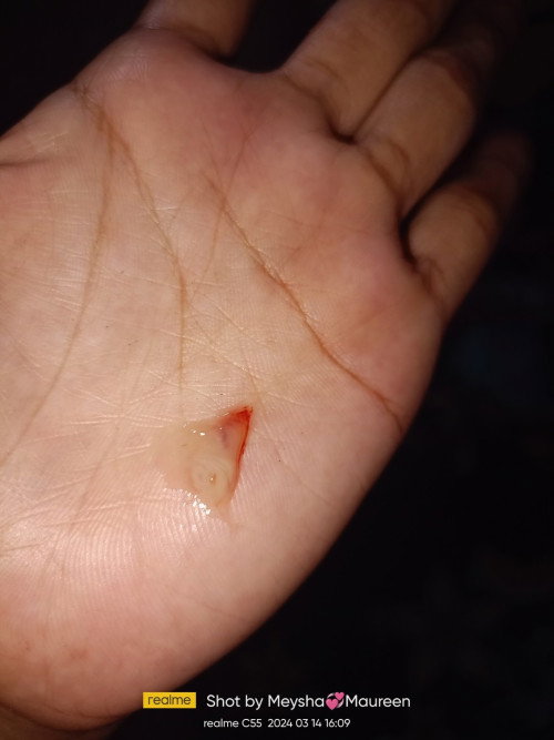Keputihan di sertai darah