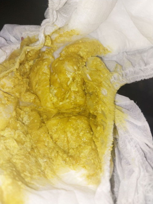 Excuse me po sa kumakain