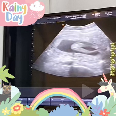 ซาวด์ดูเพศ ฉีดวัคซีนไข้หวัดใหญ่ 16วีค