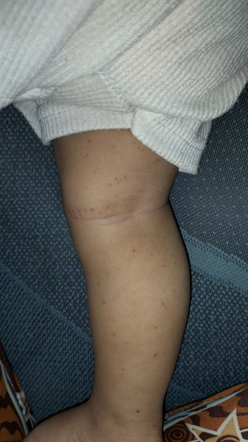 Bintik merah pada kaki