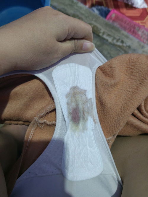 Spotting normal poba?