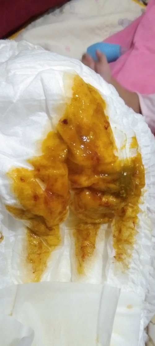 Poop seperti ada darah dan berbusa