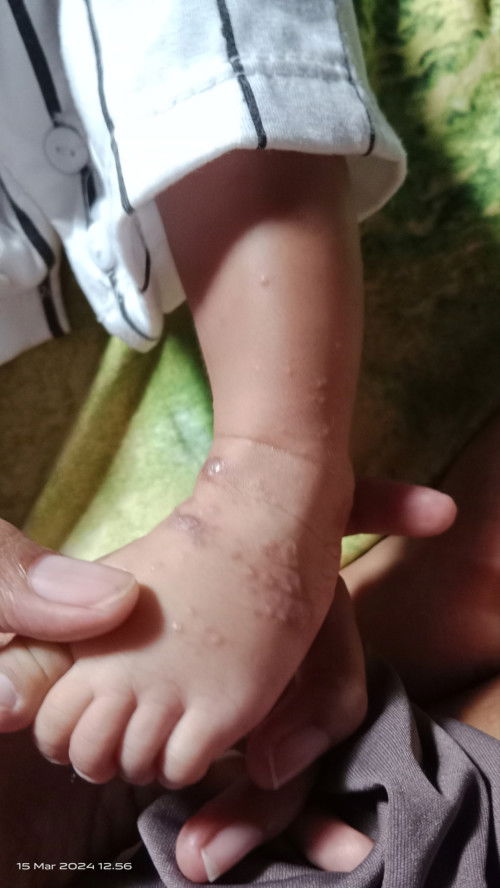 Ada yg ngalamin kek gini juga ga bun