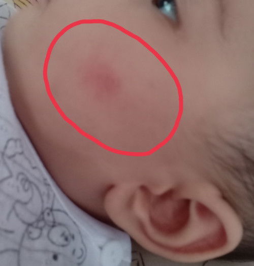 Kulit muka baby kering