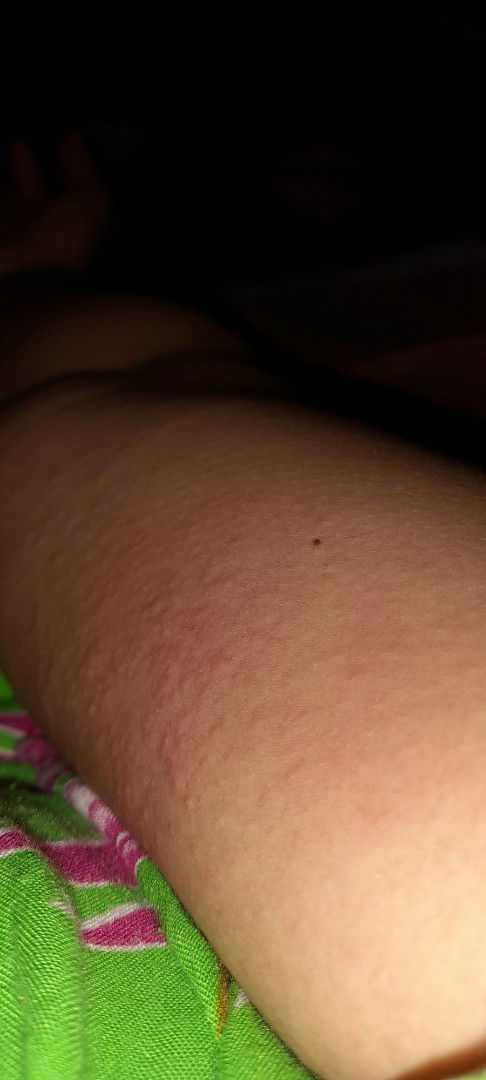 Hamil jalan 6 minggu bruntusan