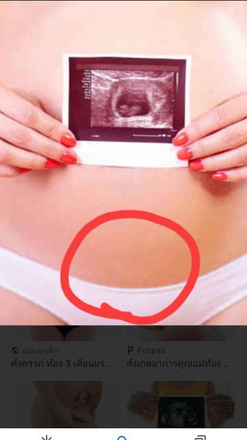 ปวดท้องน้อยหน่วงๆ