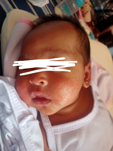 Hello po mga mommy normal lang po kaya itong nga rashes ni baby?